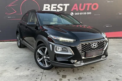 2017' Hyundai Kona